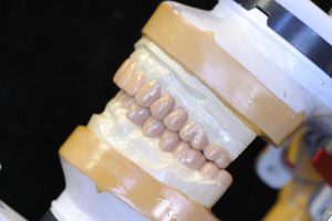Dental Stippled Wax, $6.50, December 2023 - Dental Lab Shop